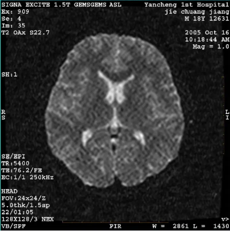АРТЕФАЦТ ВИ/Фиеста Слика Вхите Пикел